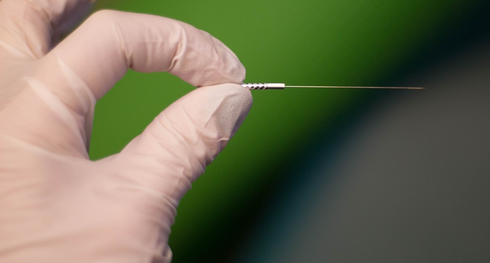 What is Dry Needling Therapy? (Reasons and Benefits)